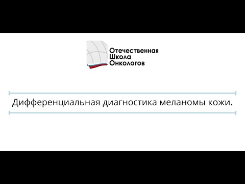 Видео: Дифференциальная диагностика меланомы кожи