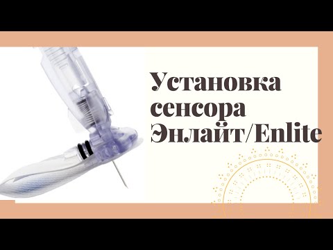 Видео: Как установить сенсор Энлайт/Enlite. Пошаговая инструкция