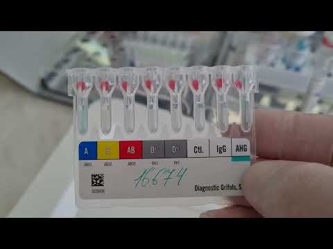 Видео: Определение группы крови и RhD моноклональными антителами. Grifols. DAT+.