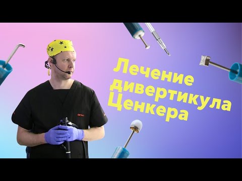 Видео: ENDO QURILTAY 2024. Эндоскопическое лечение дивертикула Ценкера
