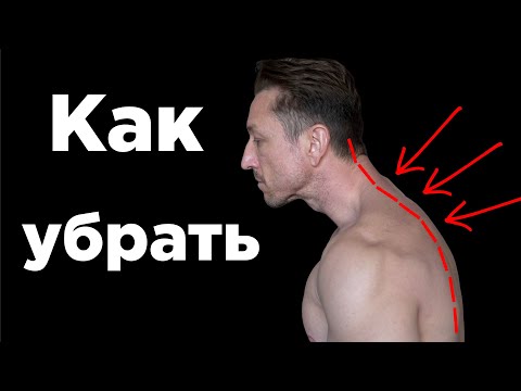 Видео: Как УБРАТЬ ХОЛКУ и СУТУЛОСТЬ?!