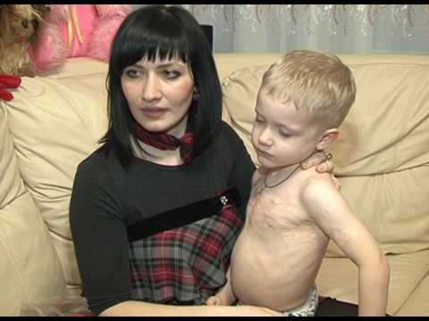 Видео: Помощь «Поколения»: реабилитация после ожога