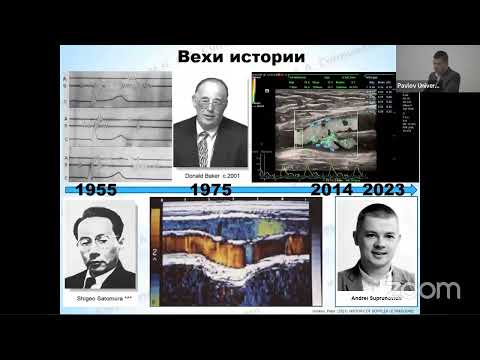 Видео: Лечить или не лечить? Ультразвуковые критерии значимости артериального стеноза