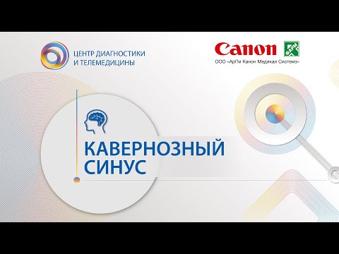 Видео: Кавернозный синус