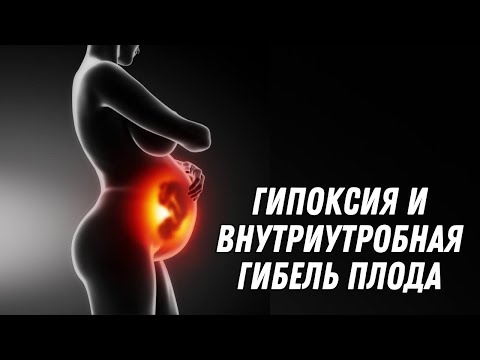 Видео: ГИПОКСИЯ И ВНУТРИУТРОБНАЯ ГИБЕЛЬ ПЛОДА @DrOlenaB #гипоксия #беременность #olenaberezovska
