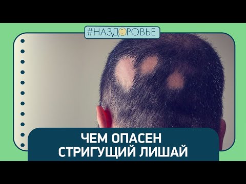 Видео: #НАЗДОРОВЬЕ: чем опасен стригущий лишай