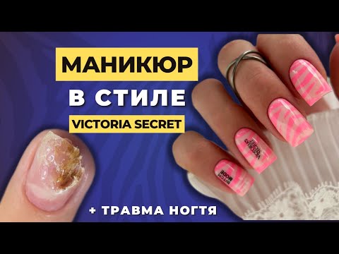 Видео: РОЗОВЫЙ маникюр в стиле Victoria Secret 💕 ТРАВМА НОГТЯ 😩 Укрепление гелем 💥