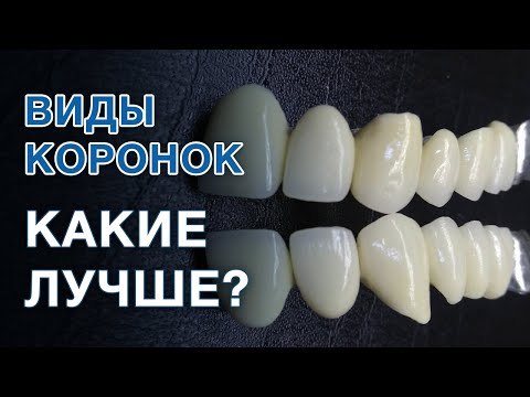 Видео: Какие коронки на зубы лучше выбрать? / Зубные коронки металлокерамика и циркониевые коронки