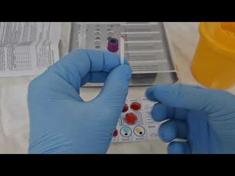 Видео: Исследования перед  трансфузией эритроцитной взвеси.