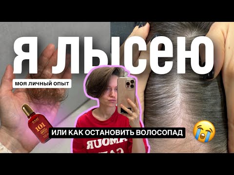 Видео: Обзор тоника Fabao 101, андрогенетическая алопеция, как остановить выпадение, заказы из китая