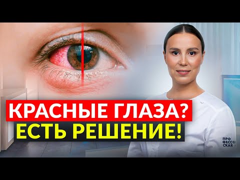 Видео: Почему краснеют глаза? Причины и первая помощь