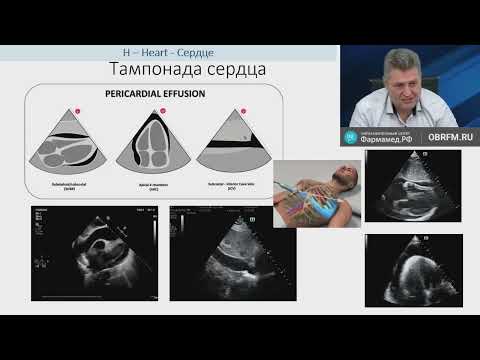 Видео: Алгоритм УЗ обсл я при ОНКробр и ОДН Лахин Р.Е. 23