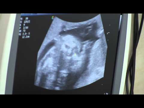 Видео: "Здраве за мен" - Какво представлява женската консултация? 12 05 15