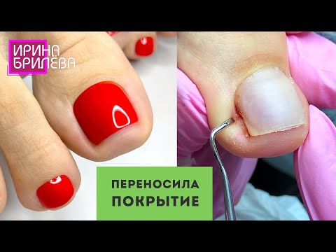 Видео: ПЕДИКЮР 🌸 Почему нельзя перенашивать покрытие 🌸 Ирина Брилёва