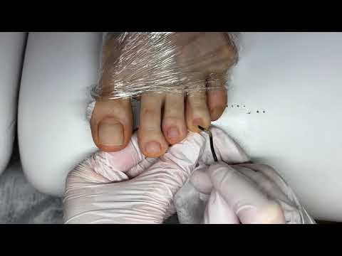 Видео: Педикюр, обработка пальчиков ног #педикюр #ногти2025 #мастеркласс #nailart #pedicure #tutorial 