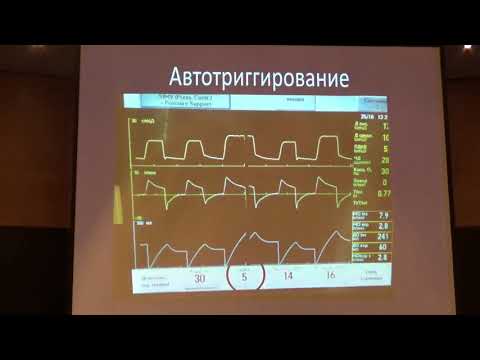 Видео: Асинхронии в ИВЛ   Полупан А.А.