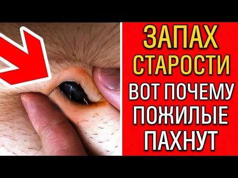 Видео: 99% ЛЮДЕЙ НЕ ЗНАЮТ, ОТКУДА БЕРЁТСЯ ЗАПАХ СТАРОСТИ - ВСЕ ДЕЛО В 1 ТОЧКЕ, КАК ОТЧИСТИТСЯ ЗА МИНУТУ!