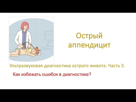 Видео: Ультразвуковая диагностика острого аппендицита