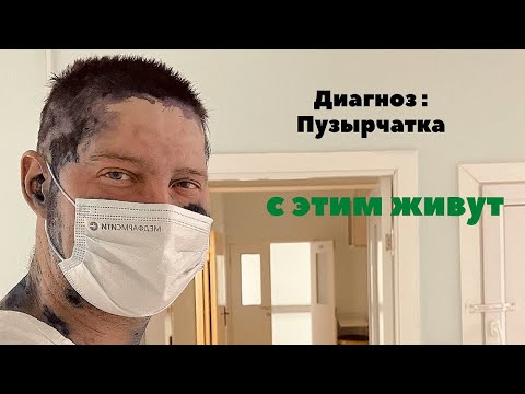 Видео: У меня диагноз пузырчатка #pemphigus