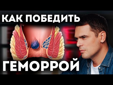 Видео: КАК ИЗБАВИТЬСЯ ОТ ГЕМОРРОЯ ? ПСИХОСОМАТИКА ГЕМОРРОЯ