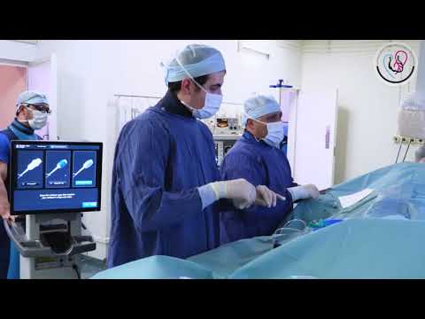 Видео: Стентирование коронарных артерий