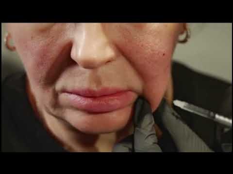 Видео: Мастер-класс Slim face c липолитиком BioGel "Стройность"