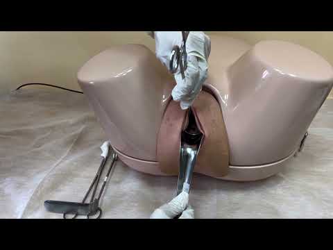 Видео: Аспирационная биопсия эндометрия