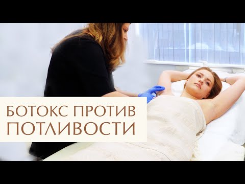 Видео: 💧 Лечение гипергидроза ботоксом избавит от повышенной потливости. Лечение гипергидроза ботоксом. 12+