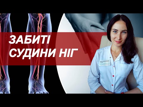 Видео: Забитые сосуды ног