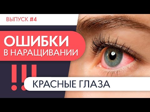 Видео: КРАСНЫЕ ГЛАЗА | Ошибки в наращивании ресниц. Выпуск №4