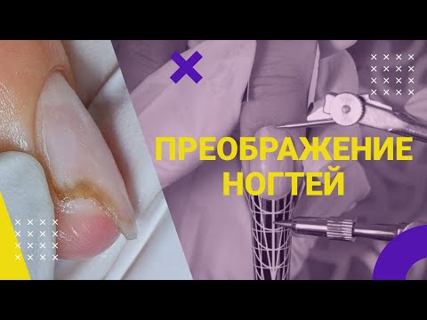 Видео: ПРОТЕЗИРОВАНИЕ ногтей 💅 Наращивание ногтей в ОДНУ каплю 💜 РЕВЕРСИВНЫЙ стемпинг
