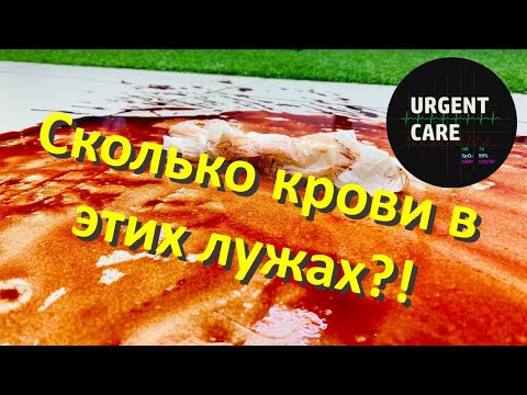 Видео: Оцениваем кровопотерю по пятну крови