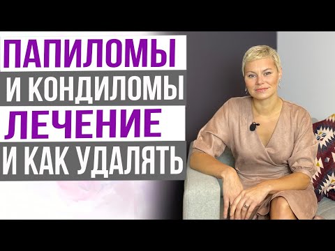 Видео: ВПЧ! Папилломы и кондиломы, лечение. Как лучше удалять. Врача Екатерина Волкова.
