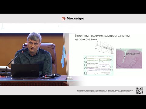Видео: Cеминар: «Применение современных методов нейродиагностики в палате интенсивной терапии»
