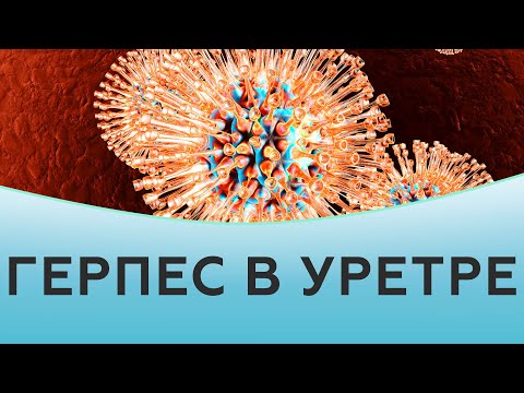 Видео: Герпес в уретре