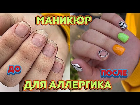 Видео: Маникюр при Аллергии на любое покрытие 💅 Гель лаки для аллергиков 💅 Красивые ногти