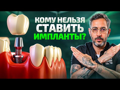 Видео: НЕудобная правда про зубные импланты. Никогда их НЕ ставьте, если...