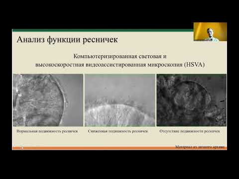 Видео: Первичная цилиарная дискинезия и синдром Картагенера у детей