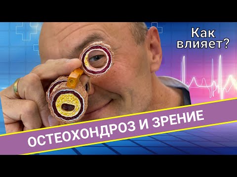 Видео: ОСТЕОХОНДРОЗ И ЗРЕНИЕ: каково влияние?