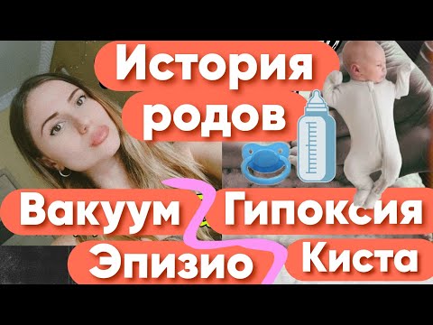 Видео: История родов. Вакуум-экстракция. Эпизиотомия. Гипоксия в родах. Киста головного мозга. Обвитие