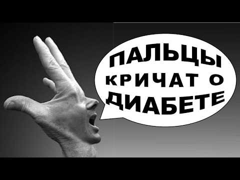 Видео: Раскрыта домашняя диагностика диабета, болезней сердца и сосудов по пальцам