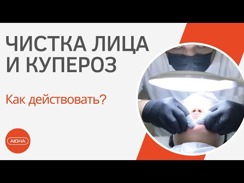 Видео: Чистка лица при КУПЕРОЗЕ. Как действовать?
