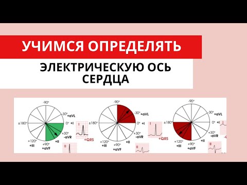 Видео: Легкий способ определить ЭОС (электрическую ось сердца)