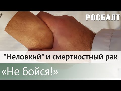Видео: Подкаст "Не бойся!" Онколог о том, почему рак толстой кишки сильно "помолодел"