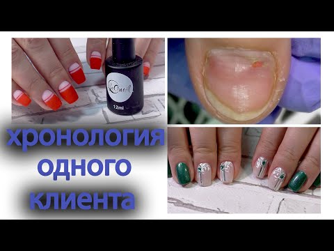 Видео: Пропил ногтей ДО ДЫРКИ! Три дизайна ногтей на ОДНОМ КЛИЕНТЕ с декабря по февраль
