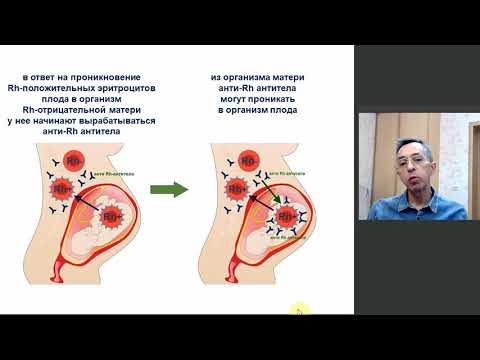 Видео: Несовместимость по резус-фактору и группе крови между организмами матери и плода - лекция