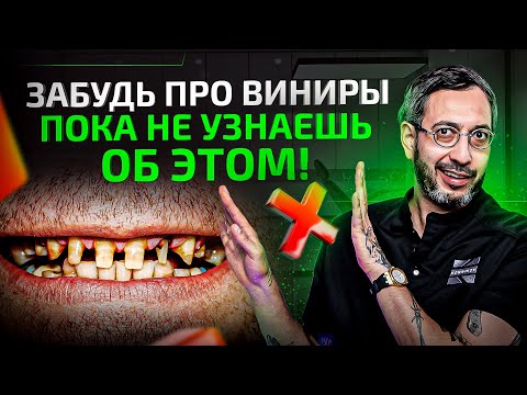 Видео: Не ставь ВИНИРЫ, пока не посмотришь это видео!