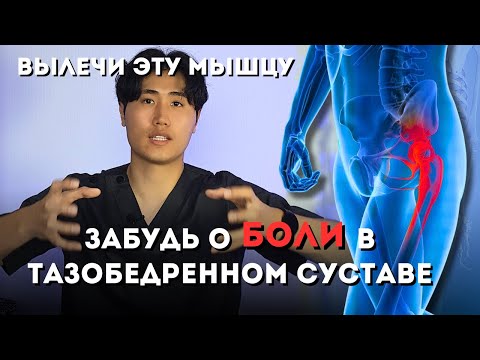 Видео: Вылечи эту мышцу и забудь о боли в тазобедренном суставе, коксартрозе