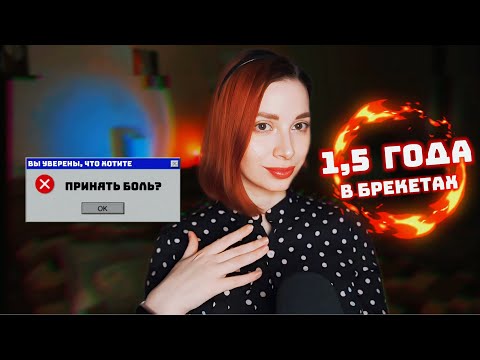 Видео: В БРЕКЕТАХ 1,5 ГОДА | Ошибки ортодонта? Отклейки и ПАРОДОНТИТ!😱 Уже пожалела 100 раз! ЗА ЧТО?!