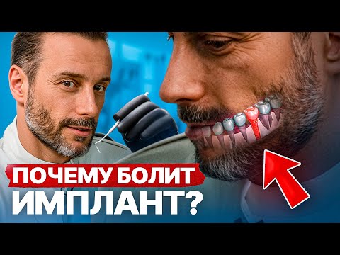 Видео: Это игнорурют 80% людей! Жалобы и осложнения после ИМПЛАНТАЦИИ зубов